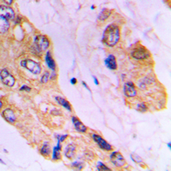 DHRS4 Antibody