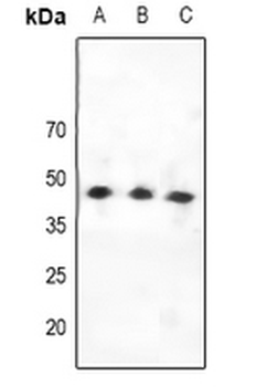 CCKAR Antibody