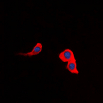 CCKAR Antibody