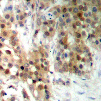 CAGE1 Antibody