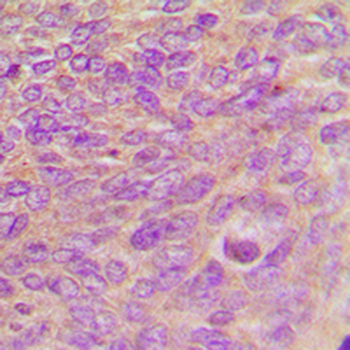 ARHGEF7 Antibody