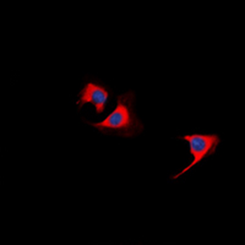 TUSC5 Antibody