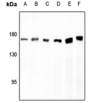 AS160 Antibody