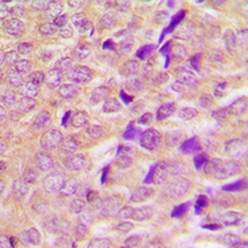 AS160 Antibody