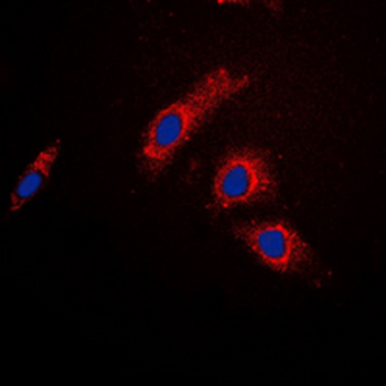 AS160 Antibody