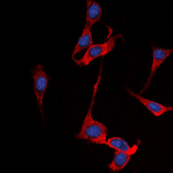 SSTR1 Antibody