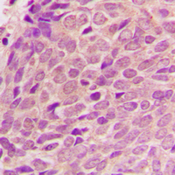 RPL12 Antibody