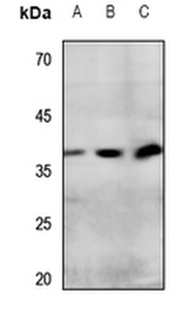 IP Receptor Antibody
