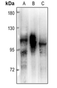 PRKD2 Antibody