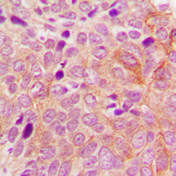 PRKD2 Antibody