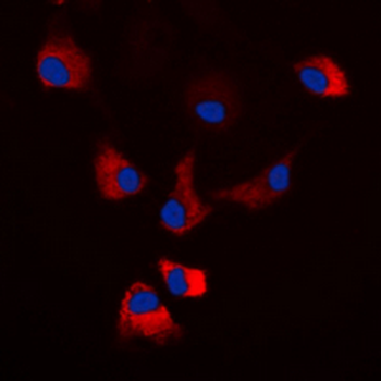 PKA C alpha/beta/gamma (pT198) Antibody