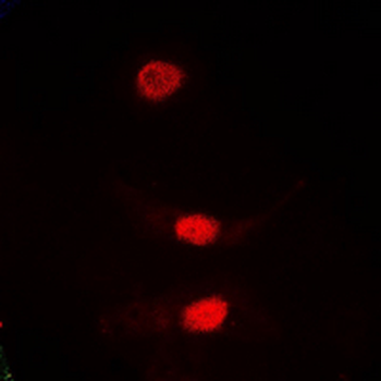PLK1 Antibody