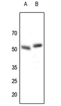 Parkin Antibody