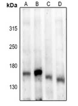 ASK1 (pS83) Antibody