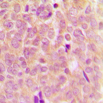 ASK1 (pS83) Antibody
