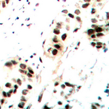 c-Jun (pS73/100) Antibody