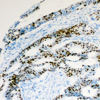 Histone H2A.Z (AcK5) Antibody