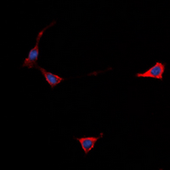 GPR101 Antibody