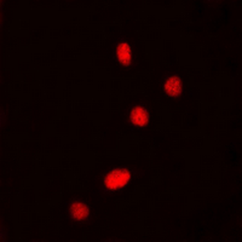 DDX5 (pY593) Antibody