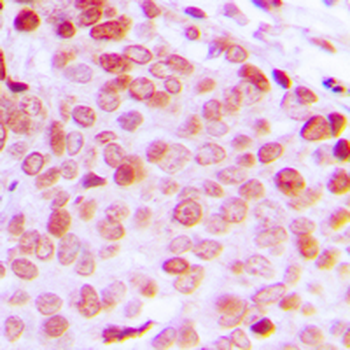 DDX5 (pY593) Antibody