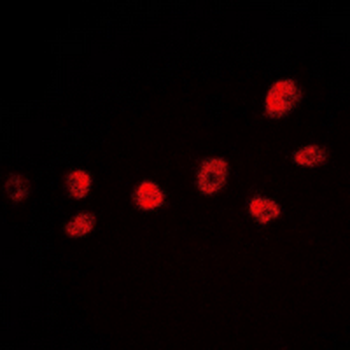 CREB (pS142) Antibody