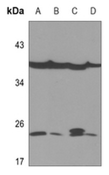 Zeta COP Antibody