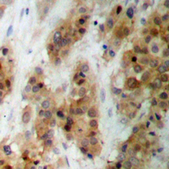 CMPK1 Antibody