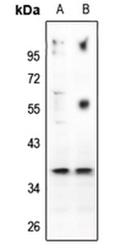 CD88 Antibody