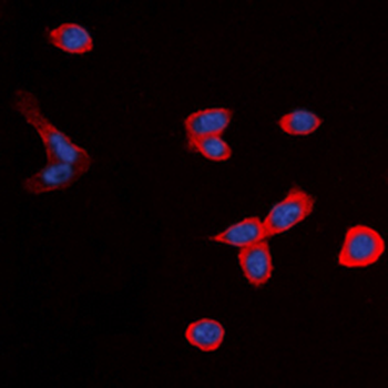 BDKRB1 Antibody