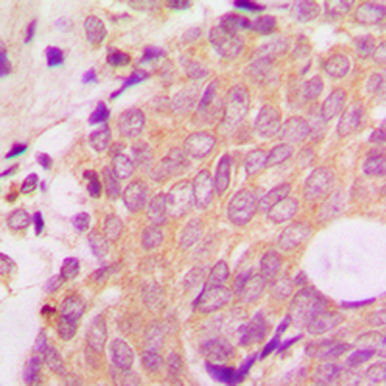 Beta-arrestin-1 Antibody