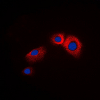 Beta-arrestin-1 Antibody