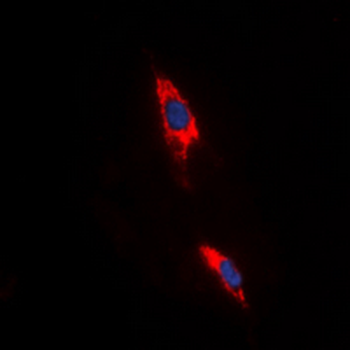 Adenosine A3 Receptor Antibody