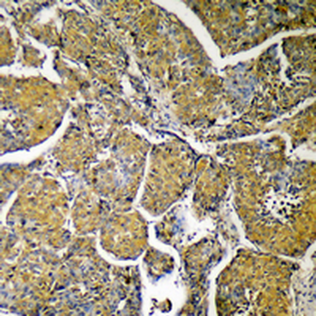 ACLY Antibody