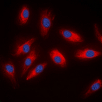 ACLY Antibody