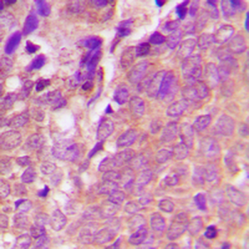 VASP (pS238) Antibody