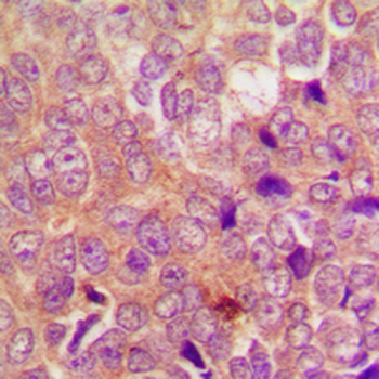 UBR1 Antibody