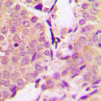 Alpha-synuclein (pY133) Antibody