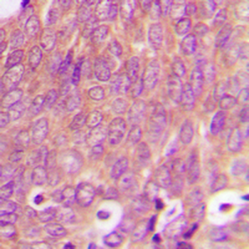 RAB6A Antibody