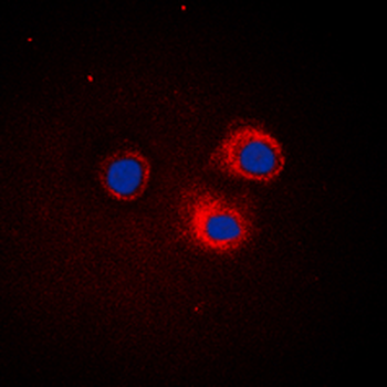 IKB epsilon Antibody