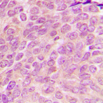 MRPL54 Antibody