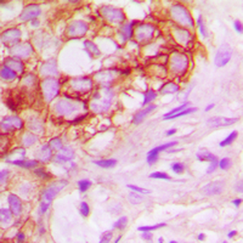 KSR1 Antibody