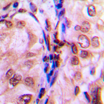 4EBP1 (pT69) Antibody