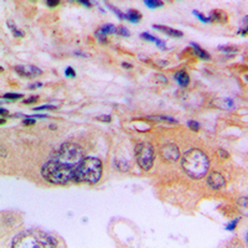 EEF2K Antibody