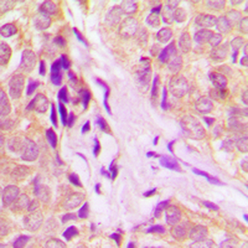 DDX55 Antibody