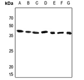 DDX52 Antibody