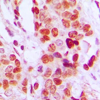 DDX52 Antibody