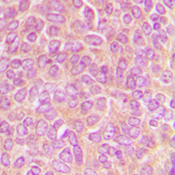 CLASP1 Antibody