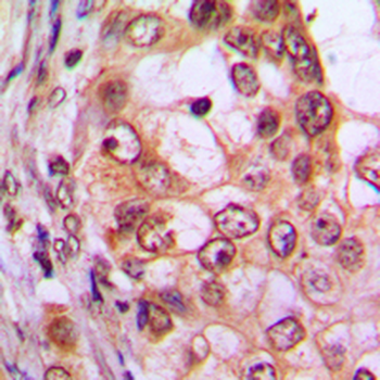 CDKL1 Antibody