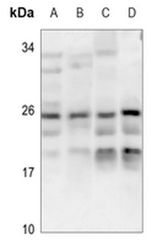 CABP7 Antibody