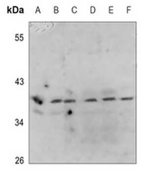 PRAS40 (pT246) Antibody